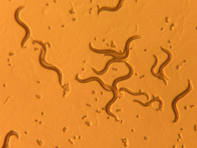 Аскаридоз: неприятные симптомы опасного заболевания и эффективные способы избавления от паразитов